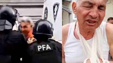 Represión en el Congreso: efectivos policiales le fracturaron el brazo a un jubilado