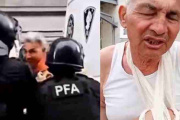 Represión en el Congreso: efectivos policiales le fracturaron el brazo a un jubilado