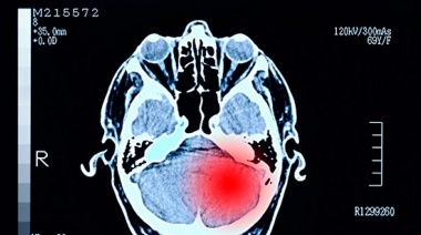 Investigadores latinos desentrañan los mecanismos moleculares que explican la eficacia de una novísima estrategia contra el cáncer