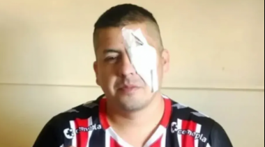 Un hincha de Chacarita denunció a Patricia Bullrich tras perder un ojo por la represión en el Congreso