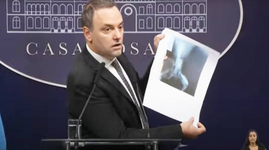 Spagnuolo trata de “pelotudo” a Adorni por mostrar la radiografía del perro